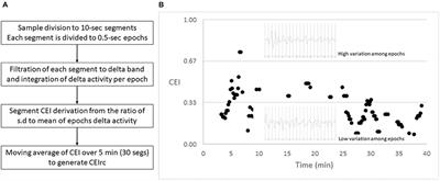 Identifying Recall Under Sedation by a Novel EEG Based Index of Attention—A Pilot Study